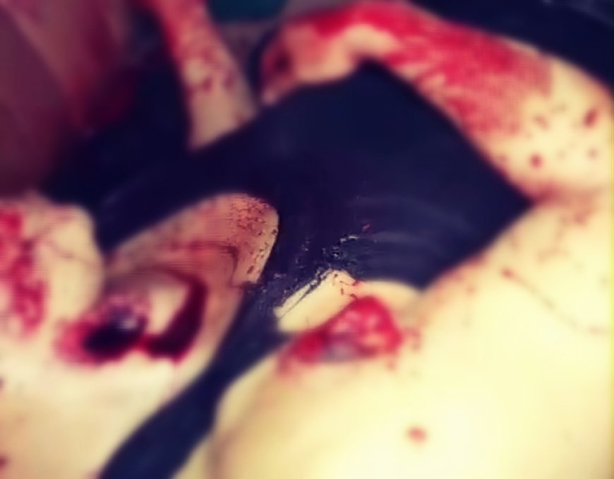 Fear has gripped residents of Sefwi Subrinkwanta following a suspected robbery attack at an illegal mining site